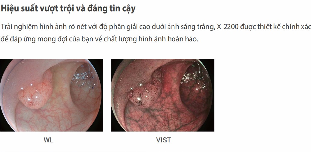Chất lượng hình ảnh vượt trội trên X2200